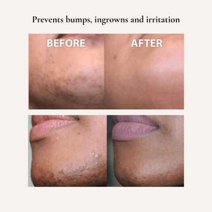 Belluxe™ Hair Trimmer