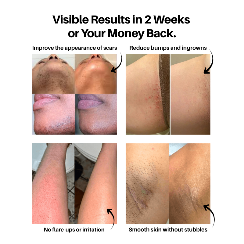 Belluxe Hair Trimmer