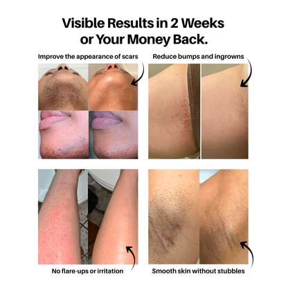 Belluxe Hair Trimmer