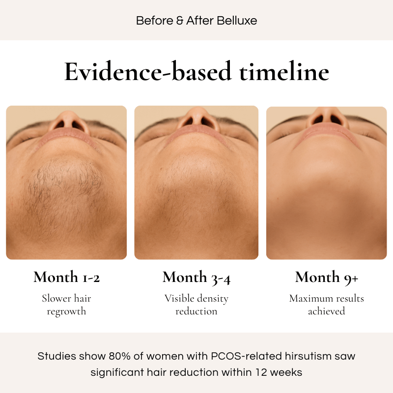 Belluxe IPL Pro