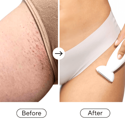 Before and after comparison of a person using a hair removal device on their leg.