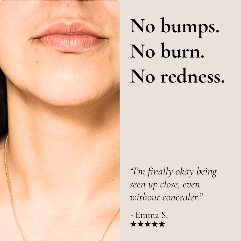 Visible difference after 1 month using Belluxe™ facial trimmer for hormonal hair growth.